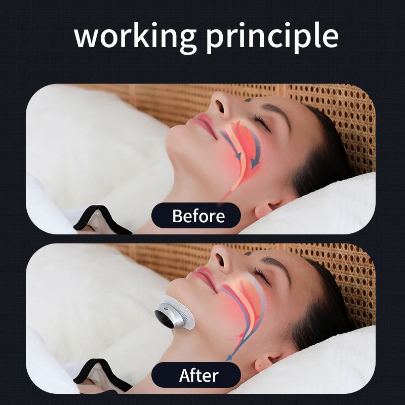 Smart Anti-Snoring Device – Dual Pulse Sleep Aid for Better Breathing